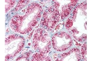 Image no. 1 for anti-Catalase (CAT) antibody (ABIN302905)