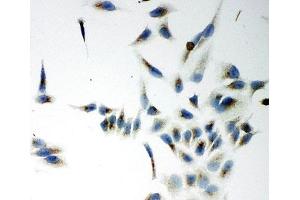 ICC testing of NOX5 antibody and HeLa cells (NOX5 anticorps  (C-Term))