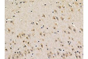 MEK1 Mouse Monoclonal Antibody at 1/100 staining mouse brain tissue by IHC-P. (MEK1 anticorps  (Internal Region))