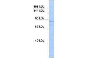WB Suggested Anti-RRBP1 Antibody Titration:  0. (RRBP1 anticorps  (N-Term))
