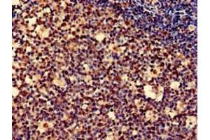 Immunohistochemistry of paraffin-embedded human tonsil tissue using ABIN7162722 at dilution of 1:100 (PDLIM2 anticorps  (AA 161-284))