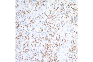 Immunohistochemistry (IHC) image for anti-Arginase, Liver (ARG1) (AA 1-322) antibody (ABIN7454020)
