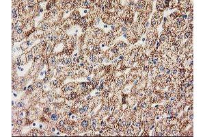 Immunohistochemical staining of paraffin-embedded Human liver tissue using anti-MMAB mouse monoclonal antibody. (MMAB anticorps)