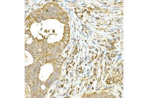 Immunohistochemistry of paraffin-embedded Mouse skin using Cytokeratin 14 (KRT14) Rabbit pAb (ABIN7268092) at dilution of 1:100 (40x lens). (KRT14 anticorps  (C-Term))