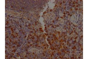 IHC image of ABIN7127409 diluted at 1:100 and staining in paraffin-embedded human tonsil tissue performed on a Leica BondTM system.