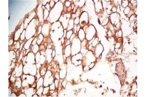 Mouse visceral fat tissue was stained by Rabbit Anti-Cathepsin S (298-331) (Human) Serum (Cathepsin S anticorps  (AA 298-331))