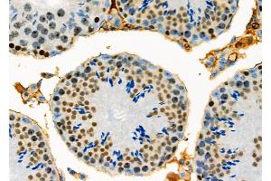 ABIN6261387 and ABIN6278336 at 1/100 staining Mouse testis tissue by IHC-P. (DUX4 anticorps)
