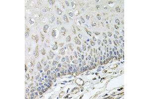 Immunohistochemistry of paraffin-embedded human esophagus using RHOT1 antibody at dilution of 1:100 (x40 lens).