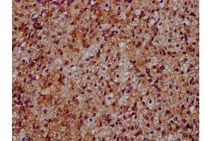 IHC image of ABIN7150800 diluted at 1:500 and staining in paraffin-embedded human adrenal gland tissue performed on a Leica BondTM system. (Dymeclin anticorps  (AA 224-348))