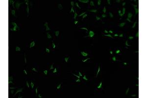 Immunofluorescence staining of SH-SY5Y cells with ABIN7152090 at 1:100, counter-stained with DAPI. (ELF2 anticorps  (AA 1-353))