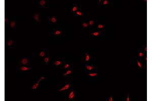 ABIN6269136 staining A549 cells by IF/ICC. (FGFR1 anticorps  (C-Term))