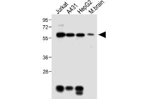 All lanes : Anti-MeCP2 Antibody at 1:2000 dilution Lane 1: Jurkat whole cell lysate Lane 2: A431 whole cell lysate Lane 3: HepG2 whole cell lysate Lane 4: Mouse brain lysate Lysates/proteins at 20 μg per lane. (MECP2 anticorps  (AA 400-428))