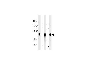 All lanes : Anti-CYK18 Antibody (C-term) at 1:2000 dilution Lane 1: HepG2 whole cell lysates Lane 2: K562 whole cell lysates Lane 3: NCI- whole cell lysates Lysates/proteins at 20 μg per lane. (Cytokeratin 18 anticorps)