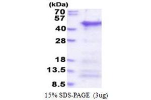 SDS-PAGE (SDS) image for Coiled-Coil Domain Containing 69 (CCDC69) (AA 1-296) protein (His tag) (ABIN6387389)
