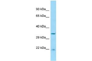 WB Suggested Anti-RGD1306739 Antibody Titration: 1. (Cabcoco1 anticorps  (C-Term))