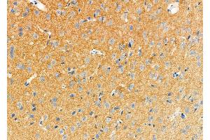 ABIN6258263 and ABIN6273482 at 1/100 staining Rat brain tissue by IHC-P. (MAP3K14 anticorps  (C-Term))