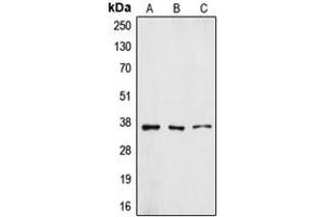 Western blot analysis of ZFP36L1 expression in A431 (A), HuvEc (B), A549 (C) whole cell lysates.