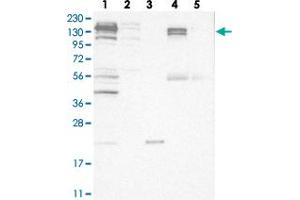 Western blot analysis of Lane 1: RT-4, Lane 2: U-251 MG, Lane 3: Human Plasma, Lane 4: Liver, Lane 5: Tonsil with CGN polyclonal antibody  at 1:250-1:500 dilution.