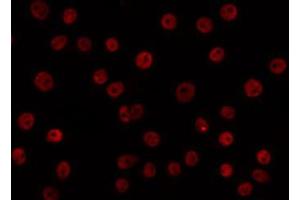 ABIN6266702 staining HuvEc by IF/ICC.