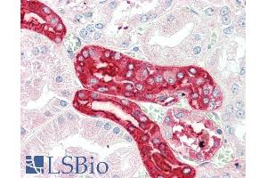 ABIN5539884 (5µg/ml) staining of paraffin embedded Human Kidney.