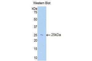Western Blotting (WB) image for anti-TIMP Metallopeptidase Inhibitor 3 (TIMP3) (AA 27-209) antibody (ABIN1860762) (TIMP3 anticorps  (AA 27-209))