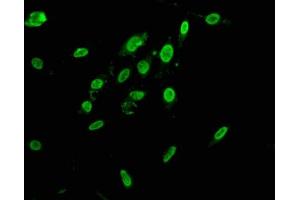 Immunofluorescence staining of Hela cells with ABIN7155093 at 1:166, counter-stained with DAPI. (HNRNPAB anticorps  (AA 1-68))