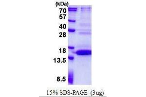 Figure annotation denotes ug of protein loaded and % gel used. (UFSP1 Protéine)