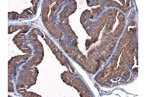 IHC-P Image Plasminogen antibody detects Plasminogen protein at cytoplasm in rat prostate by immunohistochemical analysis.