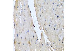 Immunohistochemistry of paraffin-embedded rat heart using DEFA1 antibody (ABIN5974152) at dilution of 1/100 (40x lens). (alpha Defensin 1 anticorps)