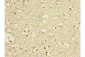Immunohistochemistry of paraffin-embedded human brain tissue using ABIN7159448 at dilution of 1:100 (GRM7 anticorps  (AA 220-410))