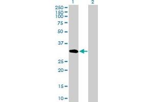 Western Blot analysis of UNC84A expression in transfected 293T cell line by UNC84A MaxPab polyclonal antibody. (SUN1 anticorps  (AA 1-257))