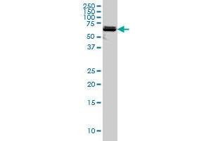 PAPSS2 monoclonal antibody (M07), clone 2A8 Western Blot analysis of PAPSS2 expression in A-431 .