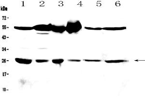 Western blot analysis of GSTM3 using anti-GSTM3 antibody . (GSTM3 anticorps  (AA 93-206))