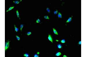 Immunofluorescent analysis of U251 cells using ABIN7160187 at dilution of 1:100 and Alexa Fluor 488-congugated AffiniPure Goat Anti-Rabbit IgG(H+L)