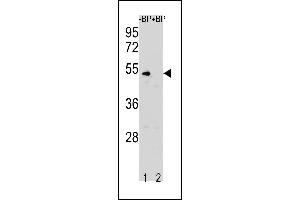 Western blot analysis of CCNB1 Antibody (N-term S9) Pab (ABIN1881151 and ABIN2843318) pre-incubated without(lane 1) and with(lane 2) blocking peptide in K562 cell line lysate. (Cyclin B1 anticorps  (N-Term))