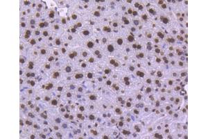 Paraformaldehyde-fixed, paraffin embedded human pancreas tissue, Antigen retrieval by boiling in sodium citrate buffer (pH6) for 15min, Block endogenous peroxidase by 3% hydrogen peroxide for 30 minutes, Blocking buffer (normal serum) at 37°C for 20min, Antibody incubation with Histone H1.