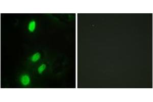 Immunofluorescence (IF) image for anti-Ets Variant 6 (ETV6) (AA 371-420) antibody (ABIN2889472) (ETV6 anticorps  (AA 371-420))
