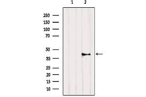Western blot analysis of extracts from HepG2, using CNR2 Antibody. (CNR2 anticorps  (C-Term))