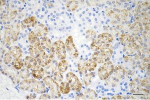 anti-AlkB, Alkylation Repair Homolog 1 (ALKBH1) antibody