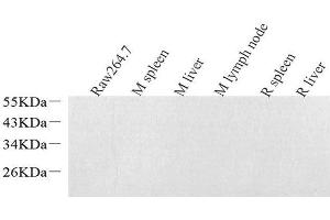 Western Blot analysis of various samples using Lysozyme Polyclonal Antibodyat dilution of 1:1000. (LYZ anticorps)