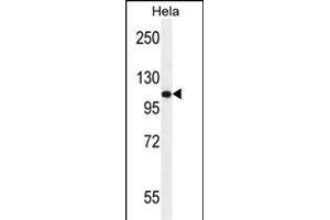 ANDR Antibody (Sumo-site) (ABIN389077 and ABIN2850530) western blot analysis in Hela cell line lysates (35 μg/lane). (Androgen Receptor anticorps  (AA 365-392))