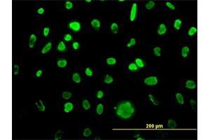 Immunofluorescence of monoclonal antibody to MCM3 on HeLa cell.