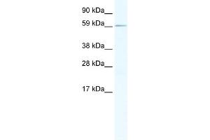 WB Suggested Anti-RBM14 Antibody Titration:  1. (RBM14 anticorps  (N-Term))