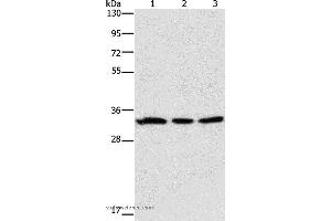 Western blot analysis of 293T and human colon cancer tissue, 231 cell, using GPA33 Polyclonal Antibody at dilution of 1:600 (GPA33 anticorps)