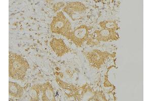 ABIN6269268 at 1/100 staining Human lung tissue by IHC-P. (PLA2G4A anticorps  (Internal Region))