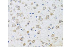 Immunohistochemistry of paraffin-embedded Mouse brain using ARL6 Polyclonal Antibody at dilution of 1:100 (40x lens). (ARL6 anticorps)
