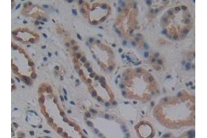 DAB staining on IHC-P; Samples: Human Kidney Tissue (WNT10B anticorps  (AA 30-322))