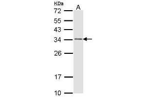 WB Image Sample (30 ug of whole cell lysate) A: H1299 12% SDS PAGE antibody diluted at 1:1000 (CAPZB anticorps  (Center))