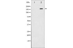 Western blot analysis of ASK1 phosphorylation expression in TNF treated 293 whole cell lysates,The lane on the left is treated with the antigen-specific peptide.