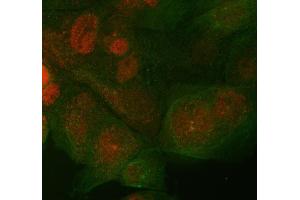 IF analysis of ST7 using anti-ST7 antibody (ABIN4886732) and anti-Beta Tubulin antibody (ABIN7602743). (ST7 anticorps  (Middle Region))